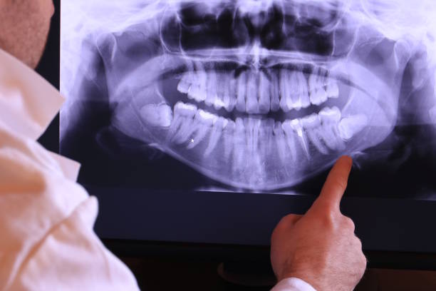 Best Broken or Cracked Tooth Emergency Dentist in Bartonville, TX