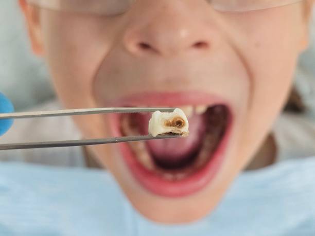 Best Emergency Dentist for Special Needs Patients in Bartonville, TX
